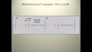 Where to listen for Heart Sounds Auscultory Areas  MEDZCOOL [upl. by Shatzer]