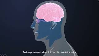 Transport of βamyloid from brain to eye causes retinal degeneration in Alzheimer’s disease [upl. by Ilyk]