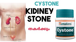 Cystone  usageside effects ampbenefits cystone in Malayalam cystone syrep kidney stone remedy [upl. by Oeniri458]