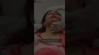 Double Chin Lipolysis Treatment [upl. by Baskett210]