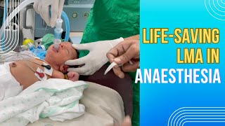 Lifesaving LMA in anaesthesia  LMA uses advantages and disadvantages are discussed [upl. by Guadalupe]