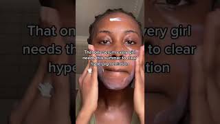 How to fade hyperpigmentation FAST [upl. by Tinaret744]