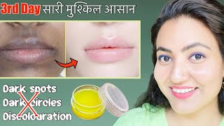 Skin Transformation Challenge Day 3  Remove Dark Spots Dark Circles amp Dark Patches Around Mouth [upl. by Nnyleahs]