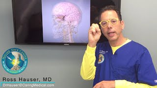 Vision problems from vagus nerve injury and cervical instability [upl. by Jp]