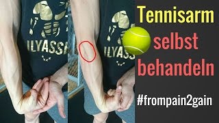 Tennisarm  Tennisellenbogen selbst behandeln  3 Methoden die funktionieren│Mischa Kotlyar [upl. by Ajiram]