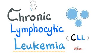 Chronic Lymphocytic Leukemia CLL  Etiology Risk Factors Symptoms Signs Diagnosis Treatment [upl. by Wiese81]