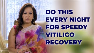 VITILIGO SPEEDY RECOVERY NIGHT TIME ROUTINE DR NITIKA KOHLI [upl. by Gregoire803]