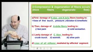 Sensory disturbances  Syringomyelia  Tabes dorsalis  Herpes zoster  peripheral neuritis [upl. by Haff226]