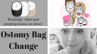 Ostomy Bag Change  The Spoonie Mummy [upl. by Annaoi212]