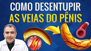 Como desentupir as veias do pênis para ter melhores ereções [upl. by Ayot]