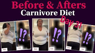 Day 31 on Carnivore Diet Before and After Pictures [upl. by Naj]