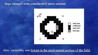 Field progression  which method to use part 1 [upl. by Oznerol]