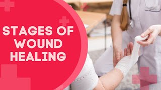 The Stages of Wound Healing [upl. by Twitt]