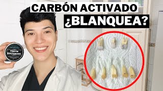 🔴 BLANQUEAMIENTO DENTAL CON CARBÓN ACTIVO  BLANQUEADOR DE DIENTES  EXPERIMENTO 100 COMPROBADO [upl. by Aztinay]