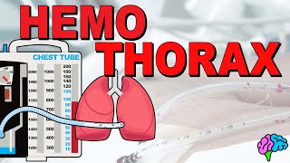 What is a Hemothorax EXPLAINED [upl. by Siramad]