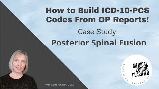 ICD 10 PCS Coding Posterior Spinal Fusion Case Study [upl. by Publea]