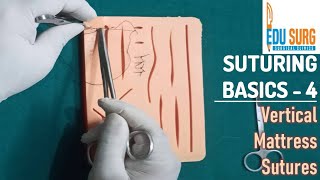 Vertical mattress suture l OSCE skill station l Suturing techniques part 3 [upl. by Obala]