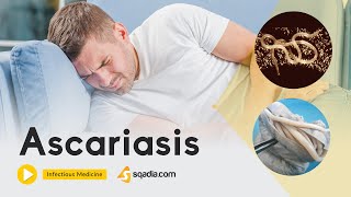 Ascariasis  Infectious Medicine Video  Medical Online Education  VLearning™ [upl. by Llecrad]