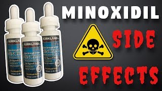 Minoxidil Side Effects  What To Expect [upl. by Assena424]