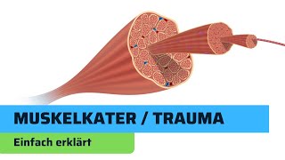 Muskelkater einfach erklärt  Fitness Basics [upl. by Gaves]