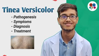 Superficial mycoses  Tinea Versicolor  Malassezia furfur  Microbiology bangla lecture [upl. by Oyr899]