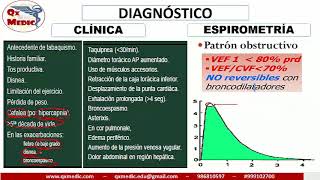 Qx neumologia  EPOC DIAGNOSTICO [upl. by Pritchard]