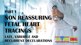 Medical Shots  Non Reassuring Fetal Heart Tracings  Part 1  Tutor IMG [upl. by Nhoj]