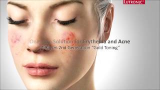 Lutronic PicoPlus  黃金玫瑰激光 Golden Laser Facial [upl. by Houghton]