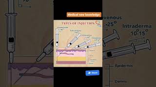 route of drug administrationmedical pharmacist medicine pharmacy administration [upl. by Miof Mela]