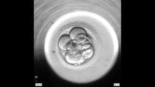 FIV  Vue au microscope du développement embryonnaire [upl. by Warchaw]