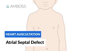 Atrial Septal Defect  Heart Auscultation  Episode 7 [upl. by Paterson420]