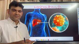 Hepatitis b treatment drniteshraj [upl. by Amadis]