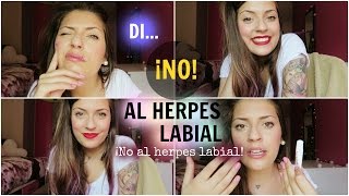 ¿CÓMO DISIMULAR UN HERPES LABIAL ✔ [upl. by Ikilisav]