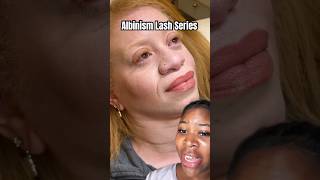 Understanding Albinism SHOWING how to learn and lash behind the scenes lashes [upl. by Jansson986]