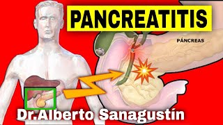 PANCREATITIS AGUDA y CRÓNICA Síntomas Causas y Tratamiento [upl. by Raskind]