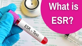 which Anticoagulant is best for esrAnticoagulant for esr sodium citrate EDTA drnajeeb [upl. by Darrick8]