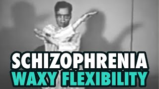 Schizophrenia and Waxy Flexibility [upl. by Jp]