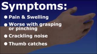 deQuervains Tendonitis  Wrist Tendonitis [upl. by Davin]