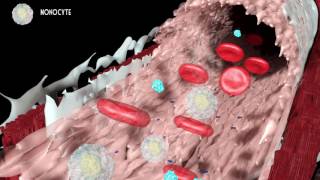 Development of atherosclerosis [upl. by Emmy850]