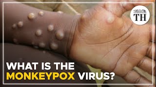 What is the monkeypox virus  The Hindu [upl. by Garris374]