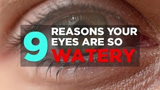 9 Reasons Your Eyes Are So Watery  Health [upl. by Tempest]