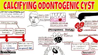 Calcifying Odontogenic Cyst  Clinical radiographic Histopathologic Features and Treatment [upl. by Aicirtac]