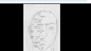 Mystery diagnosis Parry rhomburg syndrome [upl. by Anaxor]