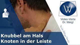 Knubbel hinterm Ohr am Hals amp Knoten in der Leiste Sind geschwollene Lymphknoten gefährlich [upl. by Cates980]