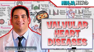 Valvular Heart Diseases  Clinical Medicine [upl. by Tran]