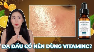 CÁC TIPS DÙNG VITAMIN C KHÔNG GÂY MỤN  Vitamin C Thượng Lưu ❗❓Da dầu có nên dùng Vitamin C không ❗❓ [upl. by Zalucki]