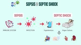 Sepsis and septic shock [upl. by Corri]