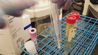 Urinalysis Preparing the 3 patient urine specimens for microscopic analysis [upl. by Aserret694]