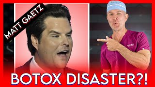 MATT GAETZ BOTOX DISASTER  PLASTIC SURGEON REACTS AND ANALYZES IT [upl. by Sherman]