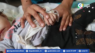 Desnutrición infantil Ocho niños han muerto de enero a junio de 2024 cuatro eran de Alta Verapaz [upl. by Gaskins]